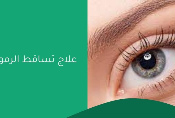 علاج تساقط الرموش