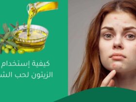 كيفية إستخدام زيت الزيتون لحب الشباب