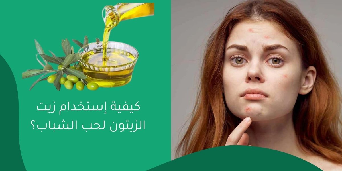 كيفية إستخدام زيت الزيتون لحب الشباب